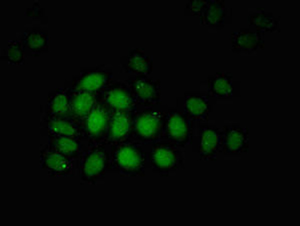 ZBTB33 Antibody (PACO53118)