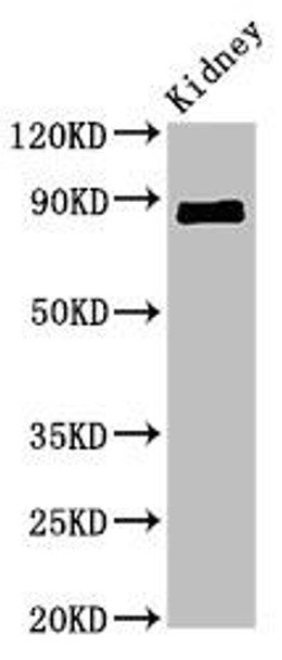 CDH18 Antibody (PACO53458)