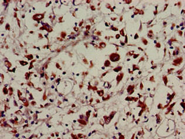 USP22 Antibody (PACO53946)