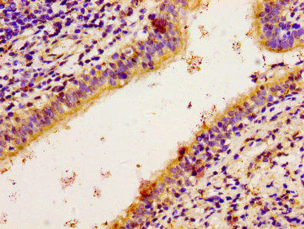 RPS6KA2 Antibody (PACO55114)