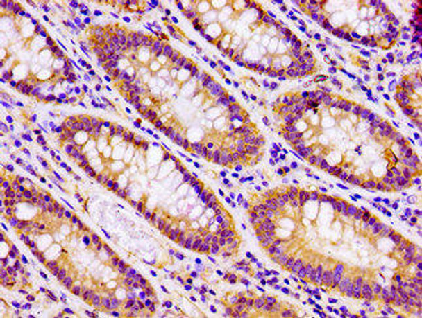 SNAP23 Antibody (PACO55790)