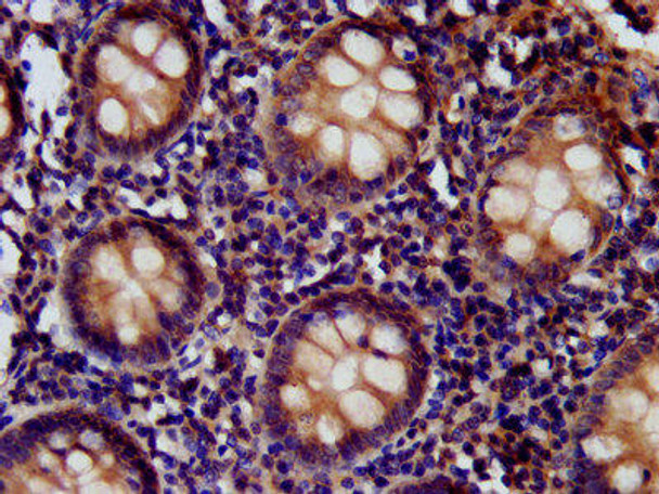 CD99L2 Antibody (PACO57348)