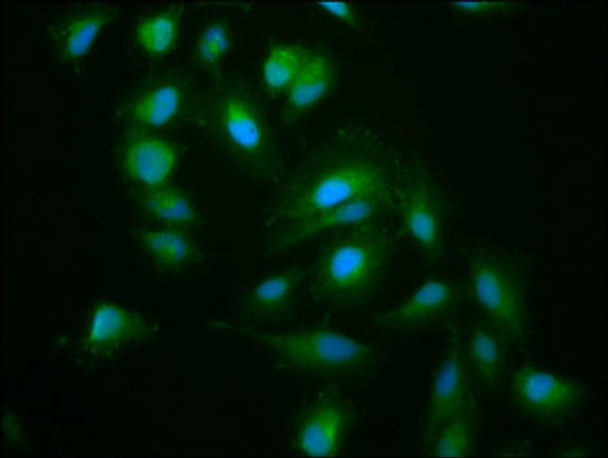 KIF15 Antibody (PACO57476)