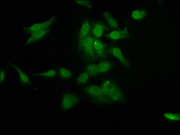 RAD54L2 Antibody (PACO57608)