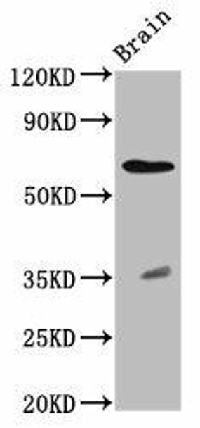 RPE65 Antibody (PACO58176)