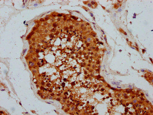 TSEN15 Antibody (PACO59289)