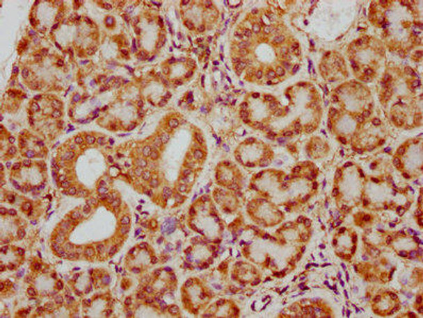 SH3BP2 Antibody (PACO60825)