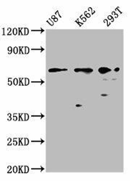 ZNF37A Antibody (PACO61314)