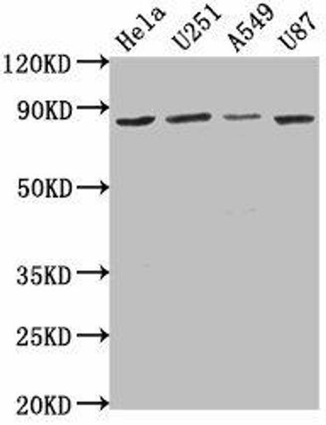 VPS51 Antibody (PACO61734)