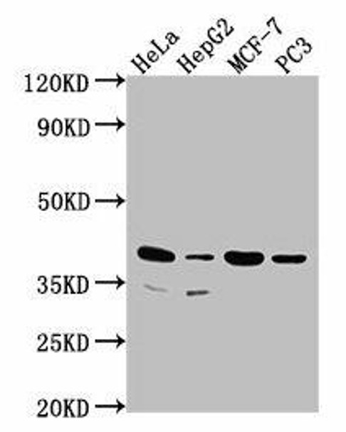 DUSP11 Antibody (PACO62875)