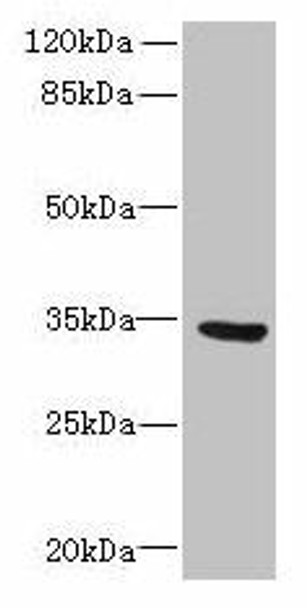 SLC25A18 Antibody (PACO41598)