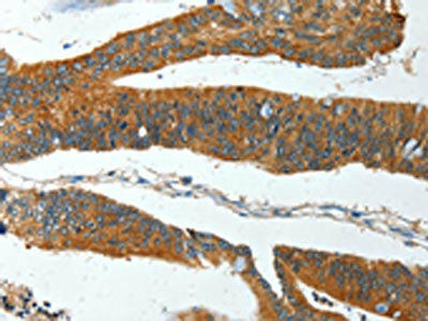 IL12RB1 Antibody (PACO13970)