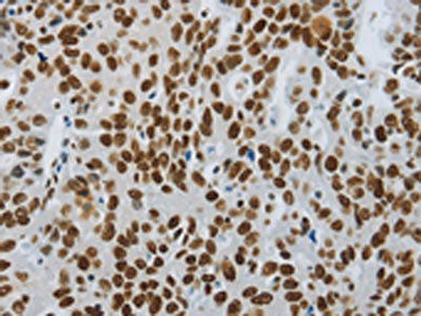 SLC16A14 Antibody (PACO18202)