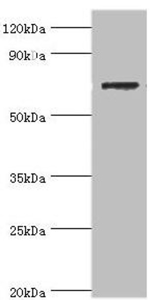 SLC25A13 Antibody (PACO43610)