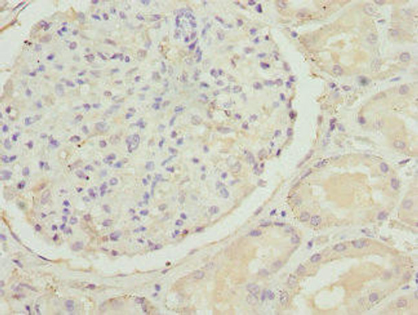 SLC22A11 Antibody (PACO44850)