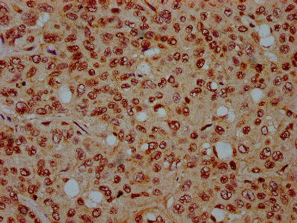 HIST1H4A (Ab-44) Antibody (PACO59609)