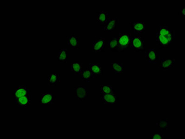 Crotonyl-HIST1H2AG (K125) Antibody (PACO59672)