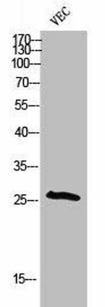 Phospho-CDKN1B (T198) Antibody (PACO02309)