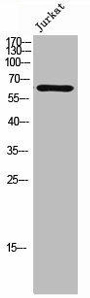 Phospho-KAT5 (S86) Antibody (PACO02331)