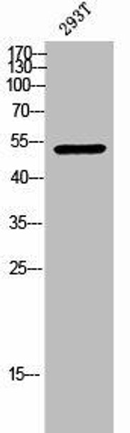 Phospho-CHEK1 (S317) Antibody (PACO02392)