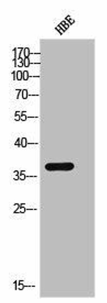 Phospho-CSNK1A1/CSNK1A1L (Y294) Antibody (PACO02492)
