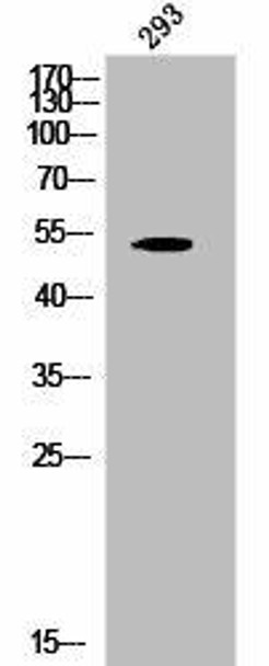 Phospho-KRT8 (S432) Antibody (PACO02856)