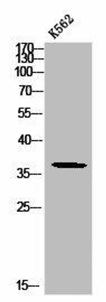 Phospho-MCL1 (S159) Antibody (PACO02894)