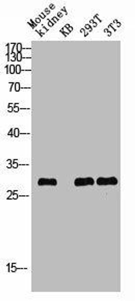 Phospho-ATF1 (S63) Antibody (PACO02920)