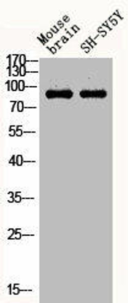 Phospho-STAT1 (Y701) Antibody (PACO06151)