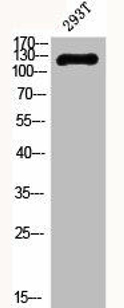 Phospho-PTK2 (Y407) Antibody (PACO06179)