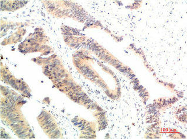 HSP90AA1 Antibody (PACO07302)