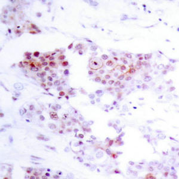 MEF2A (Ab-319) Antibody (PACO21353)