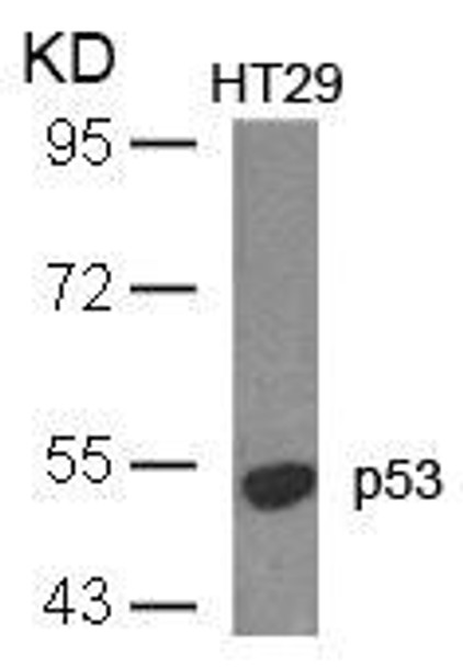 TP53 (Ab-18) Antibody (PACO21359)