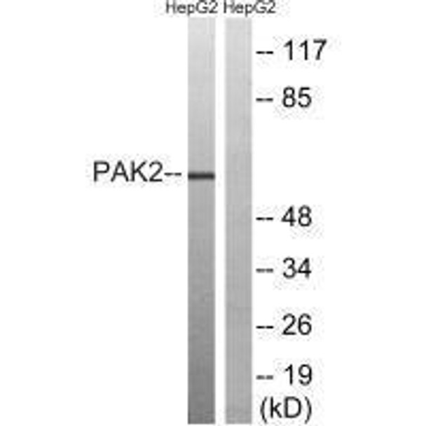 PAK2 (Ab-192) Antibody (PACO21605)