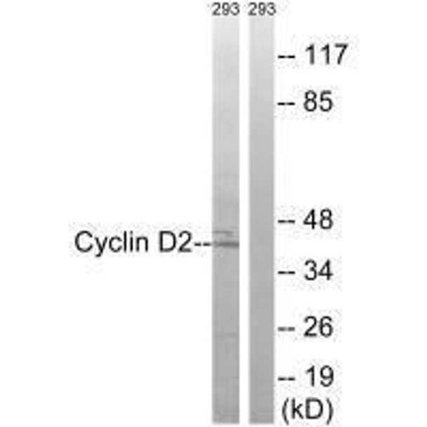 CCND2 (Ab-280) Antibody (PACO21624)