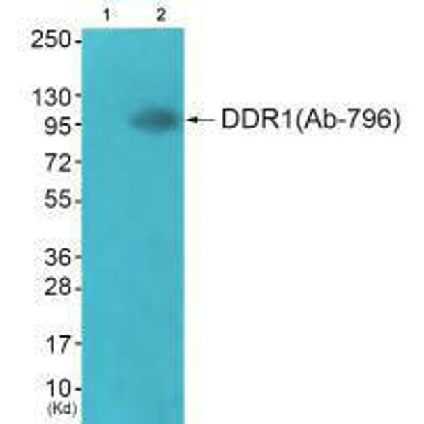 DDR1 (Ab-796) Antibody (PACO21641)