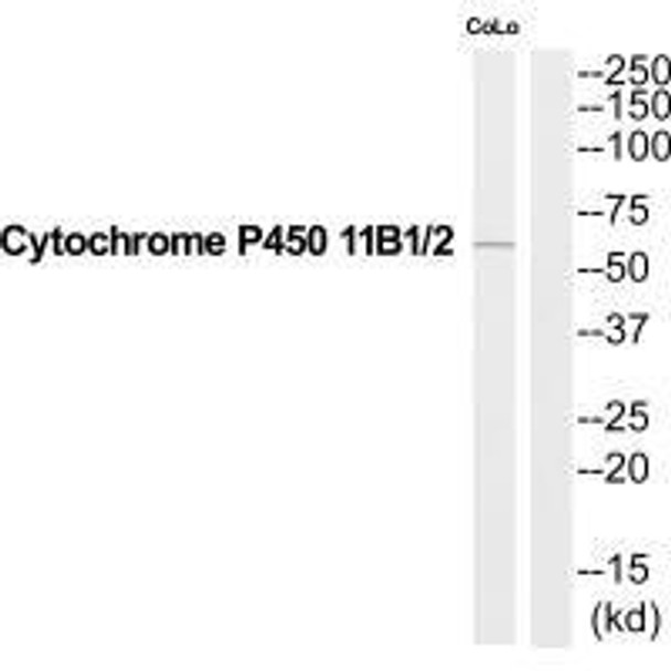 CYP11B1/CYP11B2 Antibody (PACO22740)