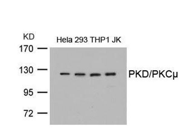 PRKD1 (Ab-738) Antibody (PACO22913)