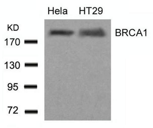 BRCA1 (Ab-1423) Antibody (PACO22955)