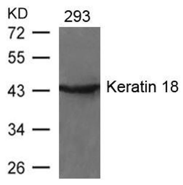 KRT18 (Ab-33) Antibody (PACO22979)