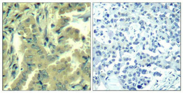 PLCG2 (Ab-1217) Antibody (PACO22997)