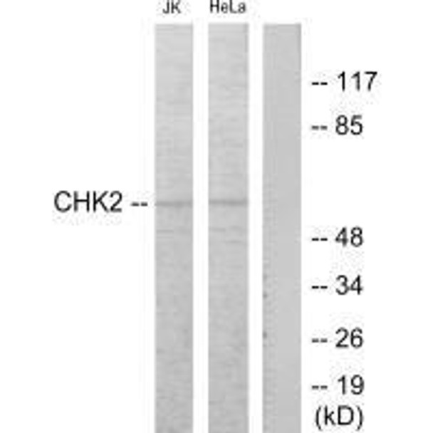 CHEK2 (Ab-68) Antibody (PACO23046)