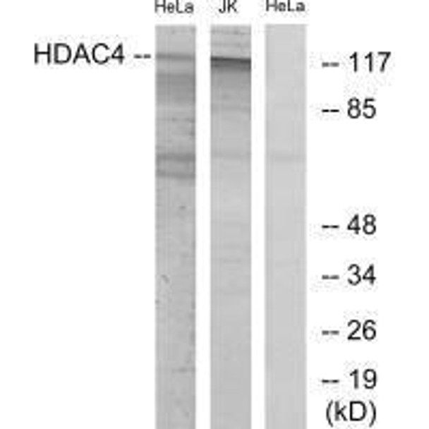 HDAC4 (Ab-632) Antibody (PACO23047)