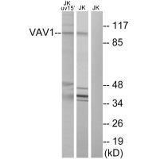 VAV1 (Ab-174) Antibody (PACO23052)