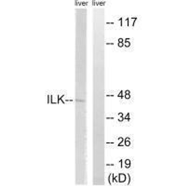 ILK (Ab-246) Antibody (PACO23175)