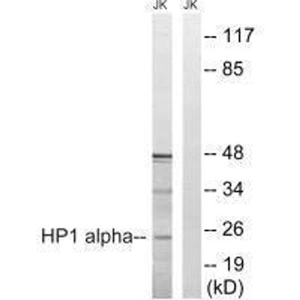 CBX5 (Ab-92) Antibody (PACO23184)