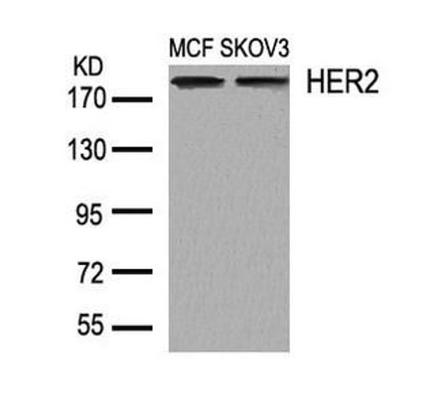 ERBB2 (Ab-1248) Antibody (PACO23548)