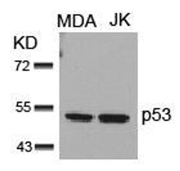 TP53 (Ab-15) Antibody (PACO23552)