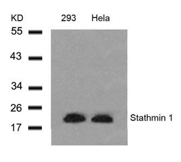 STMN1 (Ab-25) Antibody (PACO23570)