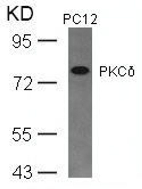 PRKCD (Ab-645) Antibody (PACO23583)